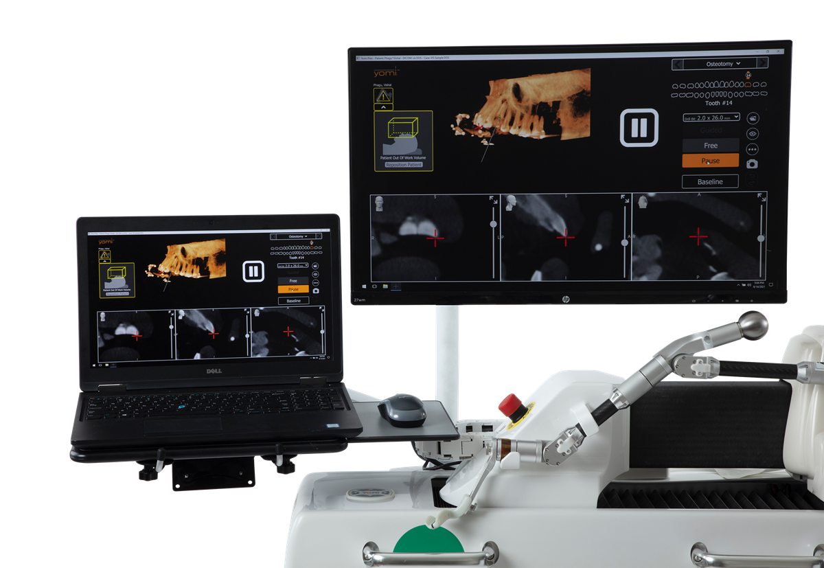 YomiPlan Implant Planning Software